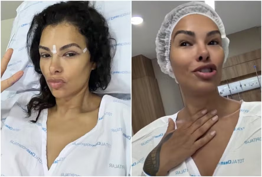 Ex-BBB Ariadna Arantes faz cirurgia para mudar a voz: ‘Mais harmoniosa’