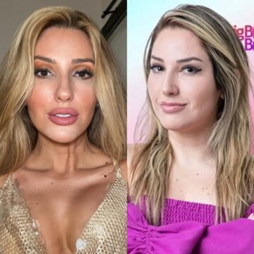 Ex-BBB Amanda Meirelles choca com transformação e revela lista de procedimentos que já fez