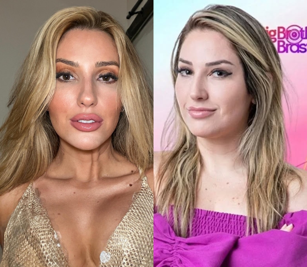 Ex-BBB Amanda Meirelles choca com transformação e revela procedimentos