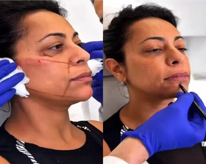 Samantha Schmütz muda visual com médico de Kim Kardashian e resultado viraliza; veja como ficou