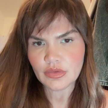 Thais Carla renova o visual com procedimento estético: ‘Se amar é se escolher’