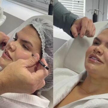 Após bariátrica, Thais Carla aplica botox e celebra: ‘Se amar é se escolher todos os dias’