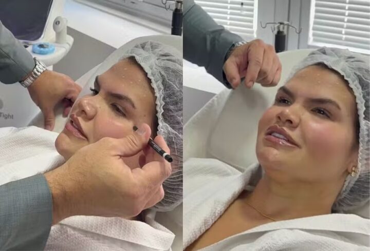 Após bariátrica, Thais Carla aplica botox e celebra: ‘Se amar é se escolher todos os dias’