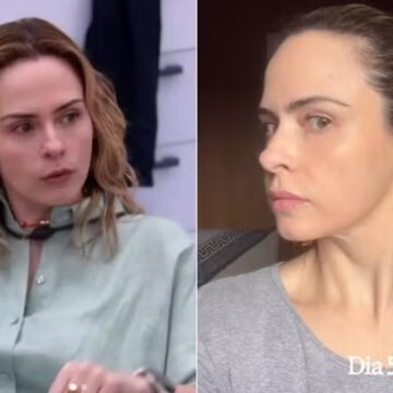 BBB 26: Ana Paula fez procedimentos estéticos no rosto um mês antes do programa; veja quais