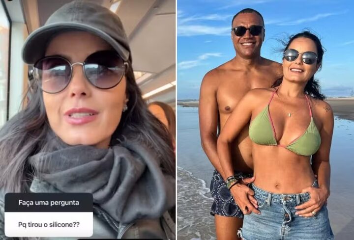 Luciele Di Camargo explica retirada de silicone dos seios: ‘Muito melhor’