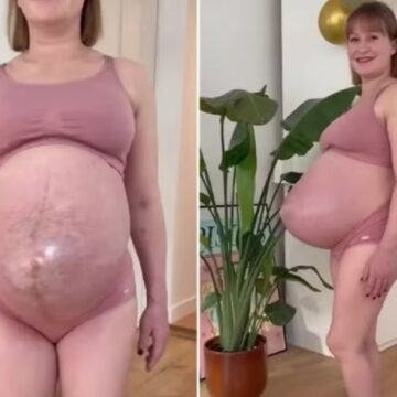 Barriga de trigêmeas com barriga pontuda viraliza nas redes sociais: ‘É incrível!’