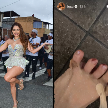 ‘Toda machucada’, Lexa mostra pé sangrando após ensaio de rua para o Carnaval