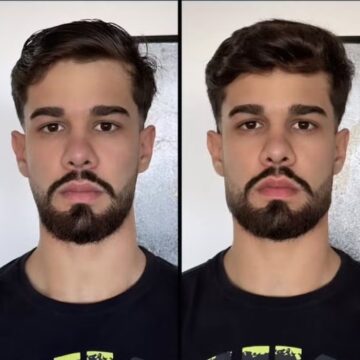 Paulo Augusto, do BBB 26, passou por harmonização facial para definir a mandíbula; veja antes e depois
