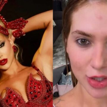 Virginia se machuca após ensaio para Carnaval com a Grande Rio: ‘Doendo’