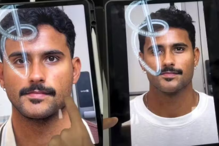 Lucas Pizane exibe antes e depois de procedimento estético: “Dar adeus a esse rosto”