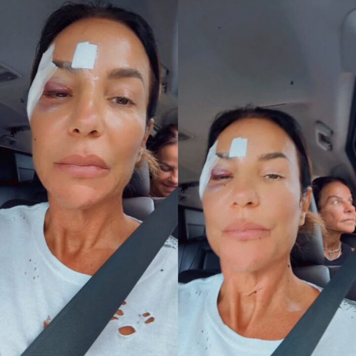 Ivete Sangalo recebe alta após queda e internação em hospital de Salvador