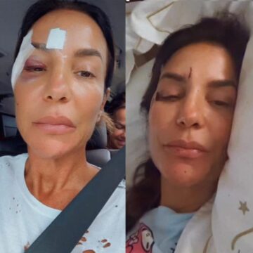 Queda de pressão e desmaio: entenda o que é síncope vasovagal citada por Ivete Sangalo