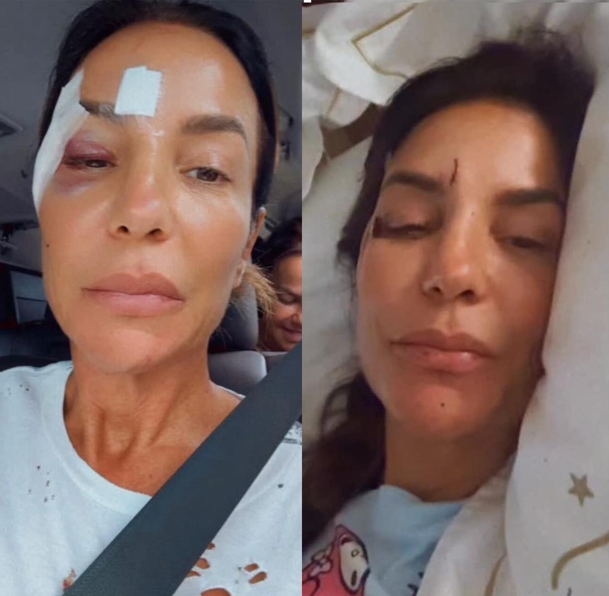 Queda de pressão e desmaio: entenda o que é síncope vasovagal citada por Ivete Sangalo