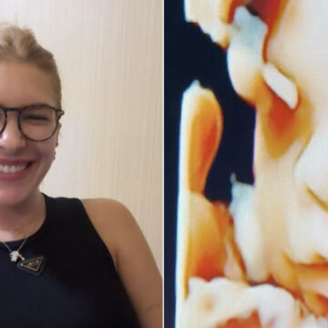 Grávida, Lore Improta faz ultrassom e brinca sobre aparência do bebê: “Perdi a chance”