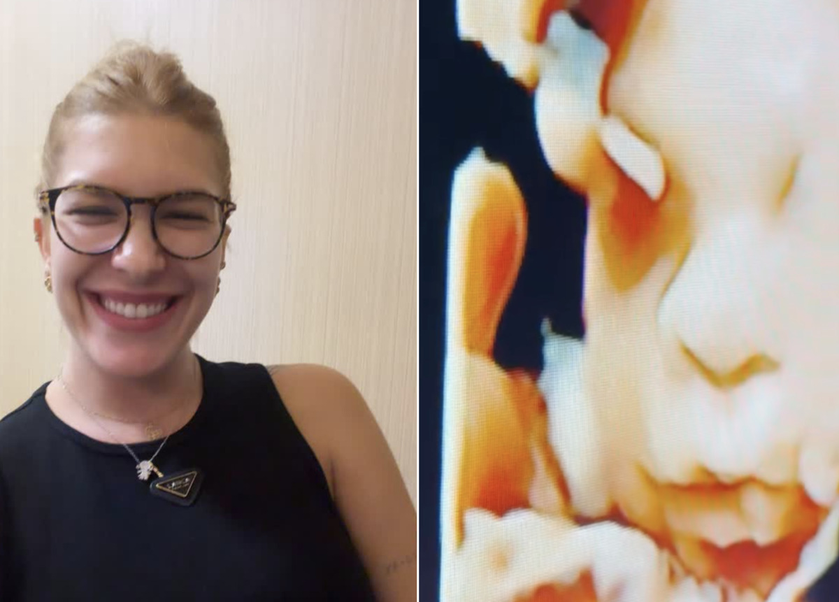 Grávida, Lore Improta faz ultrassom e brinca sobre aparência do bebê: “Perdi a chance”