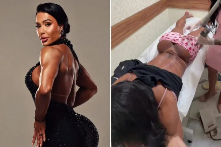 Gracyanne Barbosa inicia remoção da tatuagem íntima feita para Belo; veja vídeo