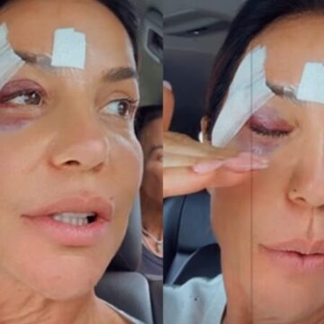 Ivete Sangalo detalha diagnóstico após desmaio e tranquiliza fãs; veja vídeo