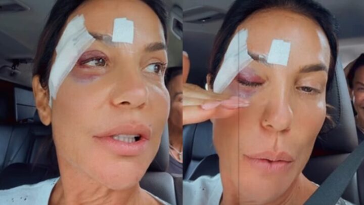 Ivete Sangalo detalha diagnóstico após desmaio e tranquiliza fãs; veja vídeo