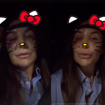 Ivete Sangalo comenta inchaço no rosto após cirurgia e confirma agenda da turnê Clareou