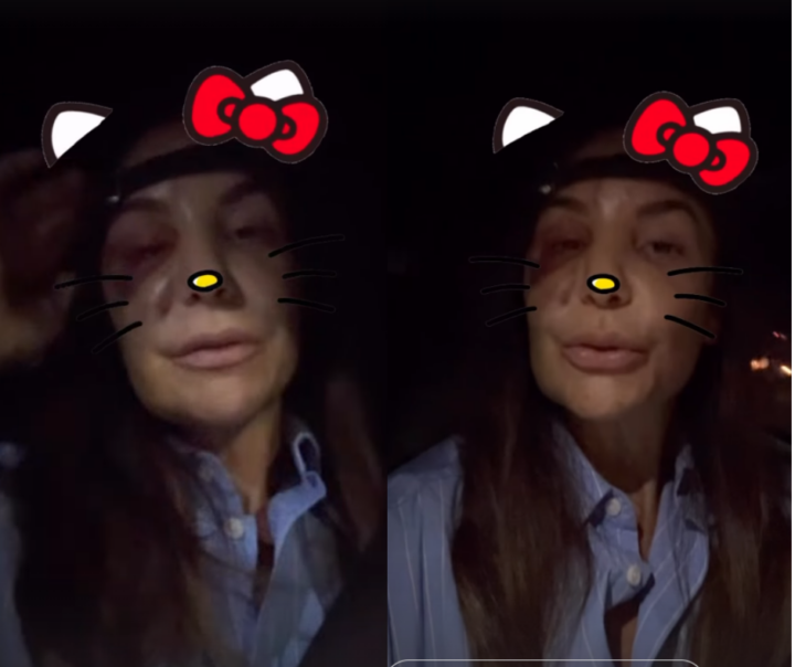 Ivete Sangalo comenta inchaço no rosto após cirurgia e confirma agenda da turnê Clareou