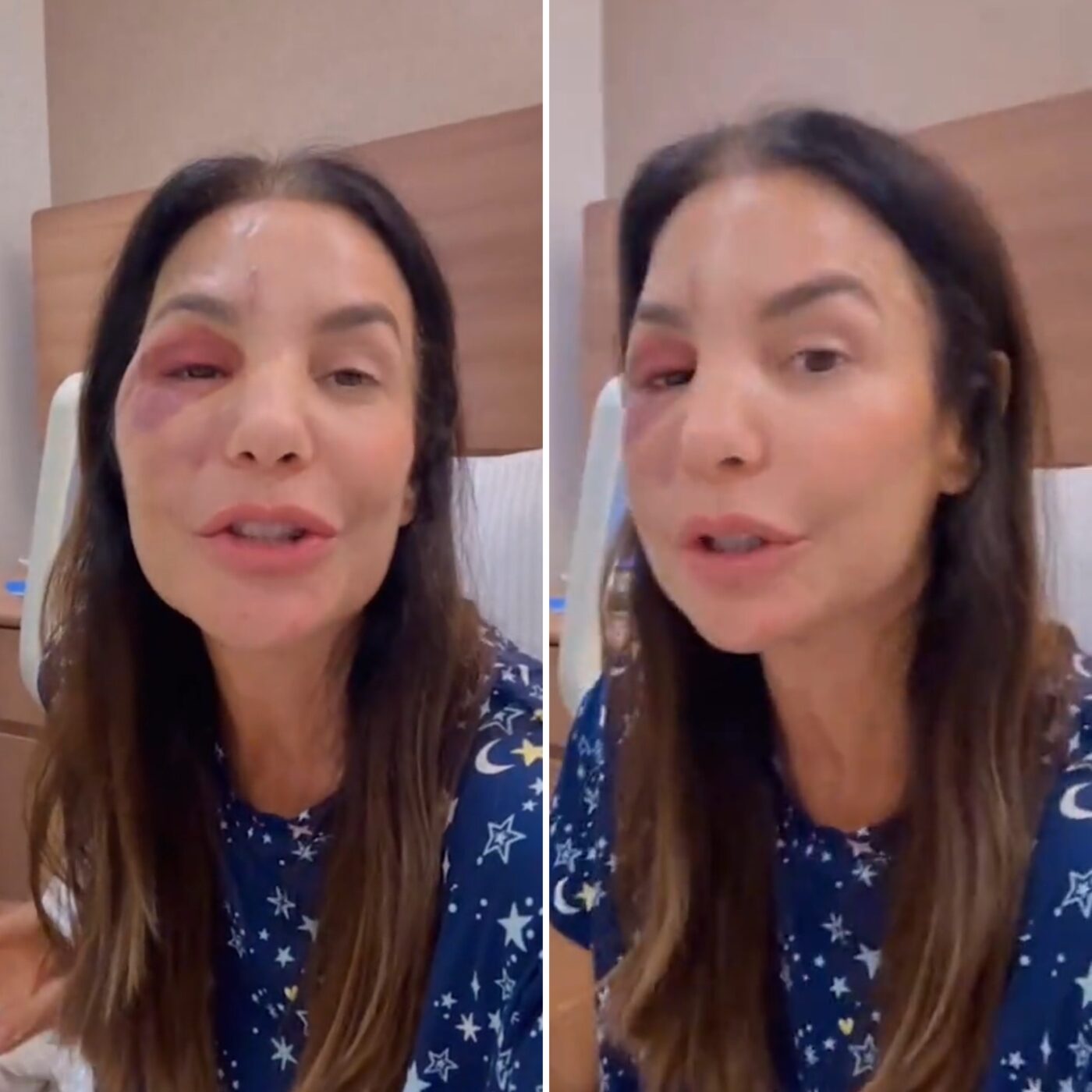 Ivete Sangalo fala pela primeira vez após cirurgia; veja vídeo