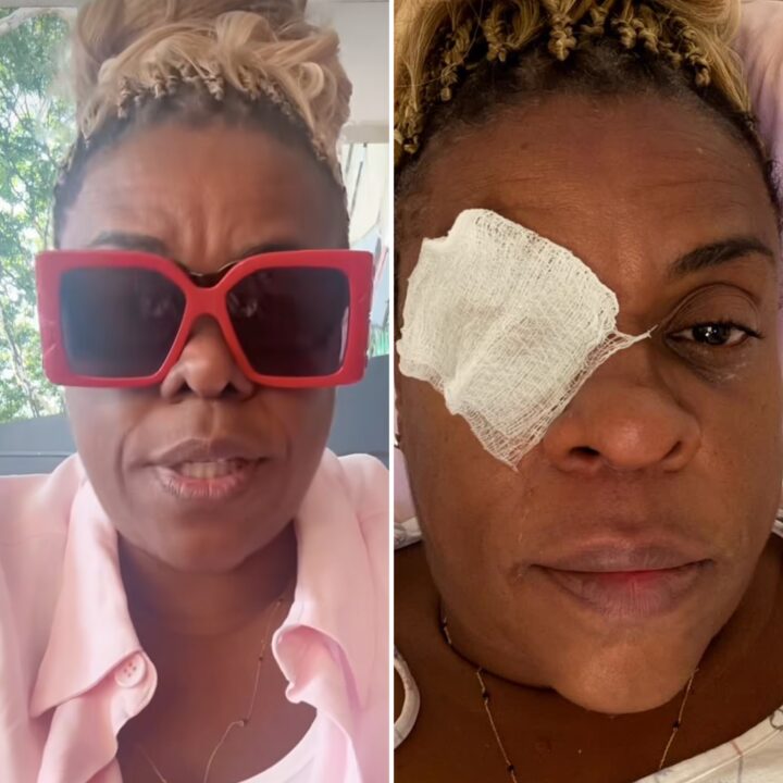 Cacau Protásio atualiza estado de saúde após reação grave a pomada capilar: ‘Voltei a enxergar’