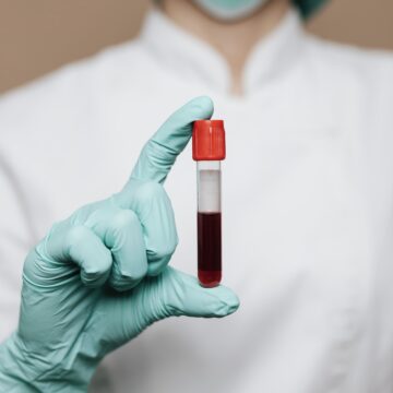 Mapeamento genético da população brasileira abre coleta de dados em Salvador; saiba como participar