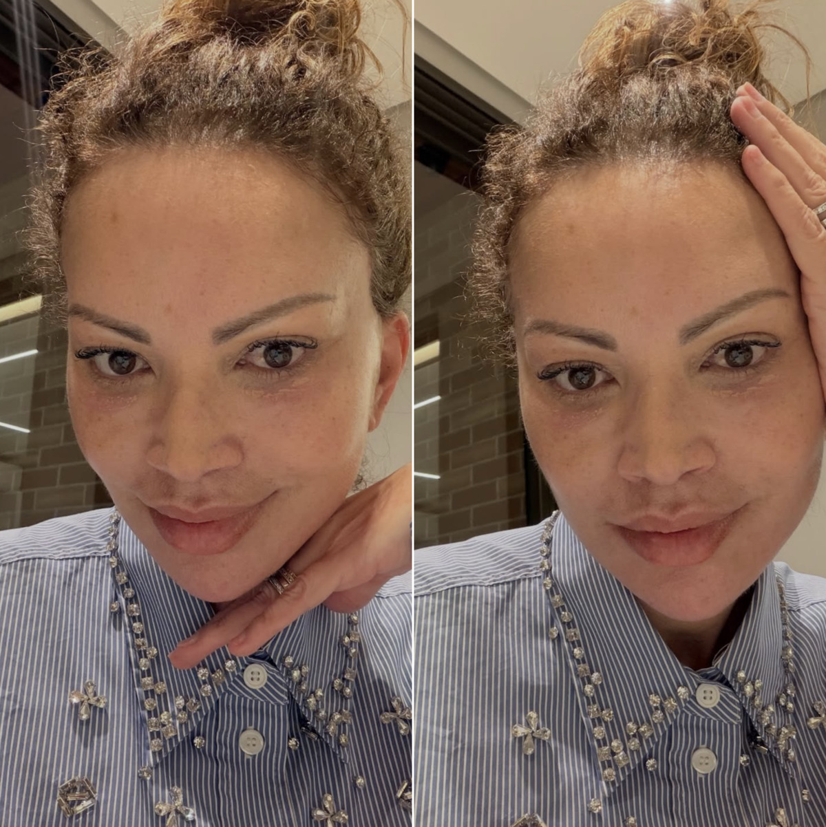 Solange Almeida mostra resultado após procedimentos estéticos no rosto: ‘Nunca foi vaidade’