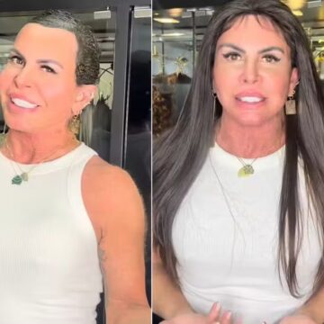 Tratando alopecia, Gretchen adota peruca: ‘Tem que parar com preconceito’