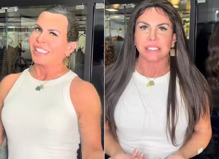 Tratando alopecia, Gretchen adota peruca: ‘Tem que parar com preconceito’