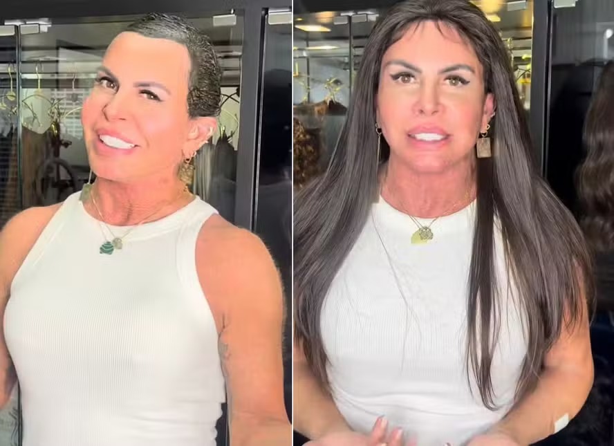 Tratando alopecia, Gretchen adota peruca: ‘Tem que parar com preconceito’