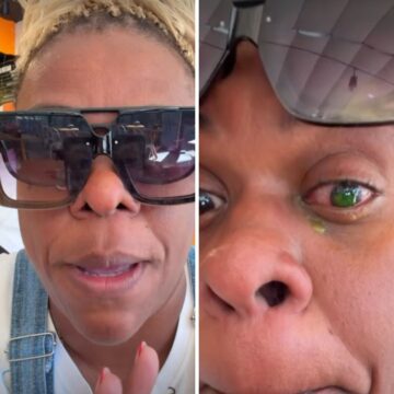 Cacau Protásio relata perda de visão após uso de pomada capilar: ‘Dor desesperadora’