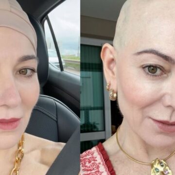 Com doença autoimune, mãe de Lucas Lucco desabafa sobre tratamento: “Realmente não é fácil”