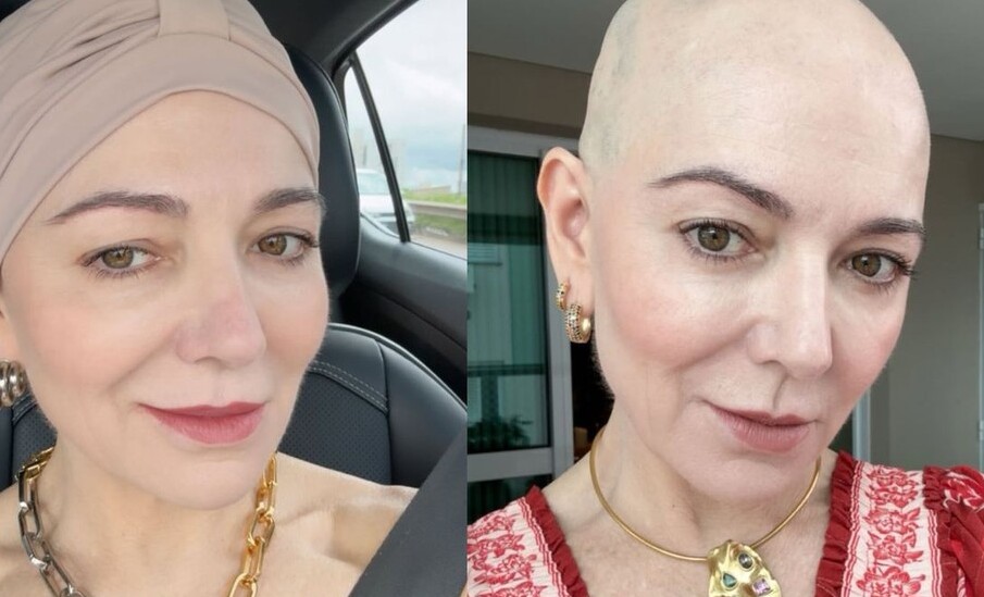 Com doença autoimune, mãe de Lucas Lucco desabafa sobre tratamento: “Realmente não é fácil”