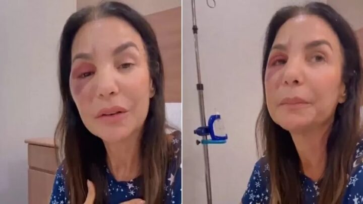 Ivete Sangalo recebe ‘chuva’ de boas energias durante recuperação de cirurgia no rosto