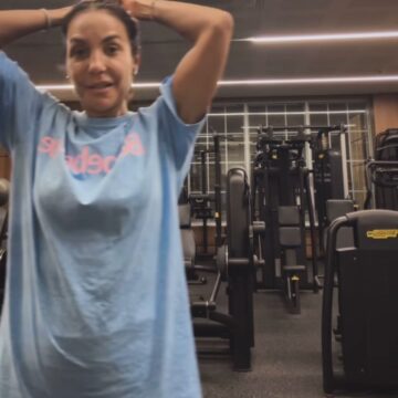 Ivete Sangalo retoma treinos após cirurgia no rosto