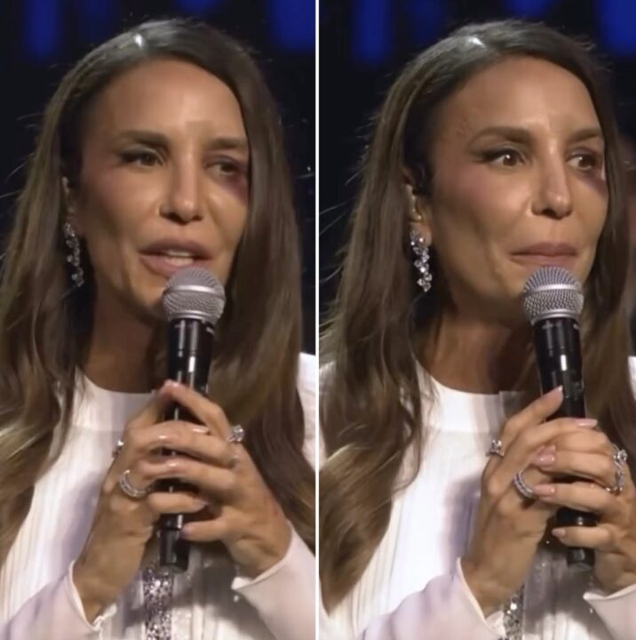 Ex-marido de Ivete Sangalo, Daniel Cady comenta postagem do Alô Alô Bahia  sobre cirurgia da cantora