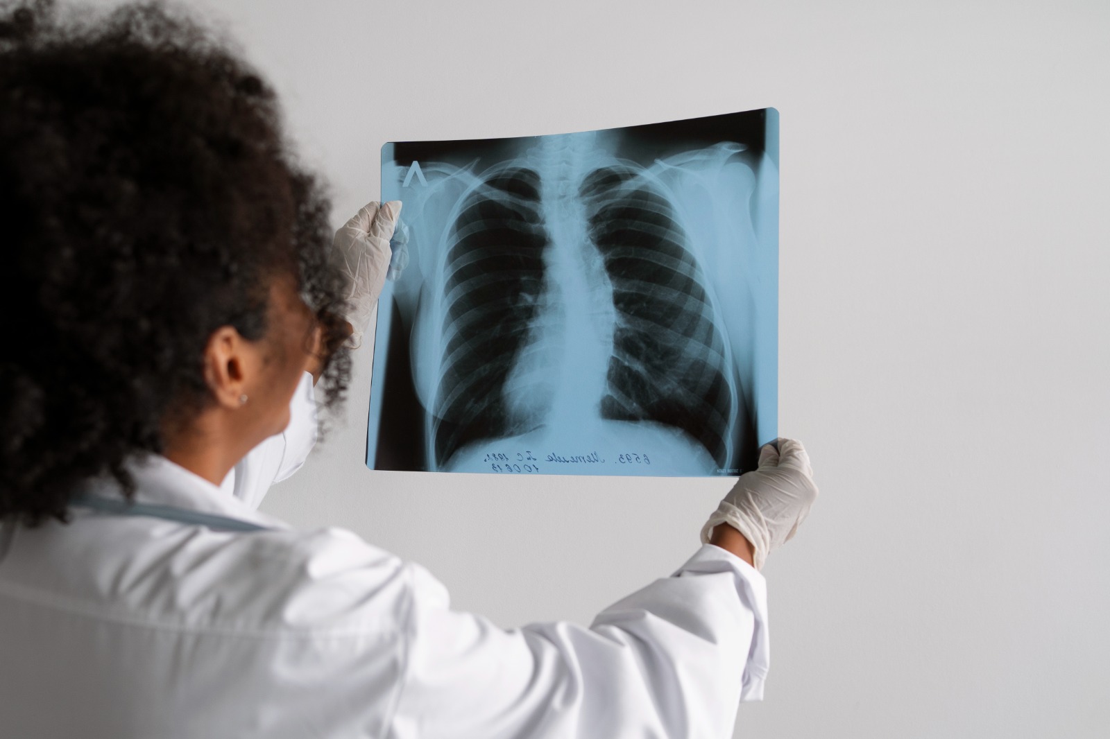 Tosse por mais de 3 semanas? Salvador alerta para tuberculose e reforça diagnóstico precoce