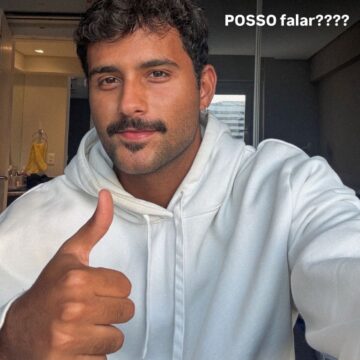 Ex-BBB Lucas Pizane corrige assimetria facial; veja antes e depois