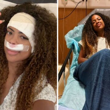 Cantora Marvvila passa por cirurgia após descobrir tumor no ouvido