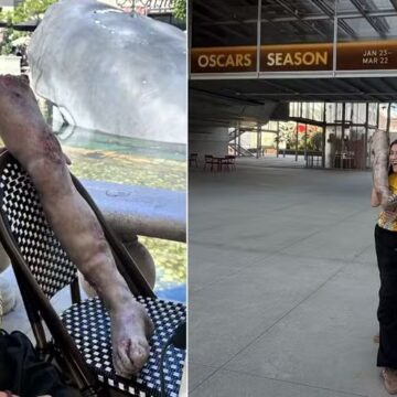 Isadora Ruppert leva “perna cabeluda” de O Agente Secreto para passear em Los Angeles