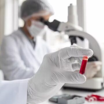 Senado aprova projeto para acelerar acesso à imunoterapia contra o câncer no SUS