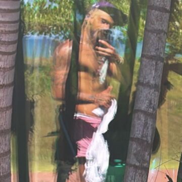 Implante de testosterona de Zé Felipe: entenda os efeitos e os riscos do chamado ‘chip’