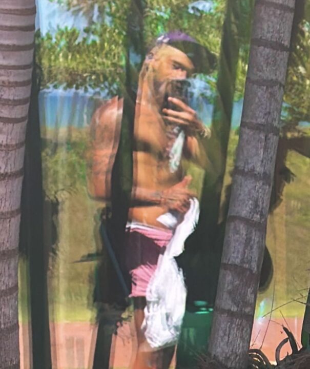 Implante de testosterona de Zé Felipe: entenda os efeitos e os riscos do chamado ‘chip’