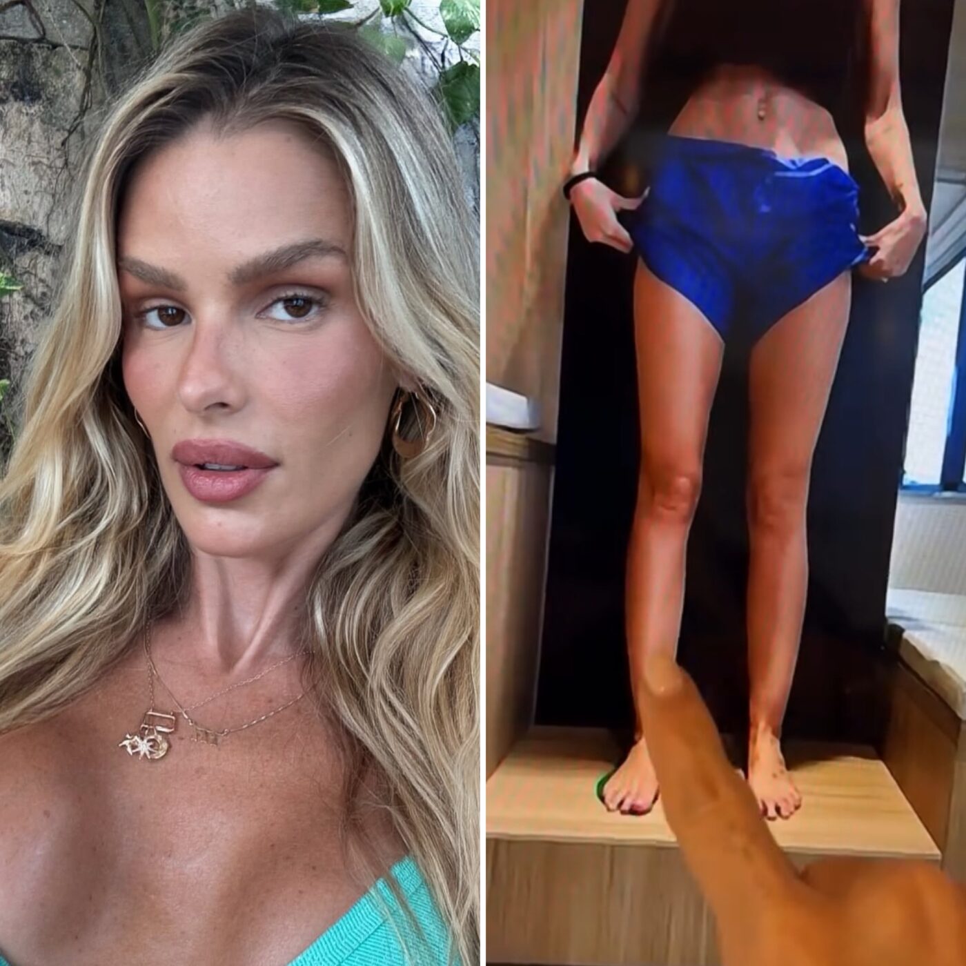 Yasmin Brunet perde 25 quilos e celebra resultado de tratamento contra lipedema