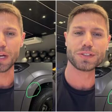 Ex-BBB Jonas Sulzbach tranquiliza fãs após acidente: ‘Dei uma raspadinha’