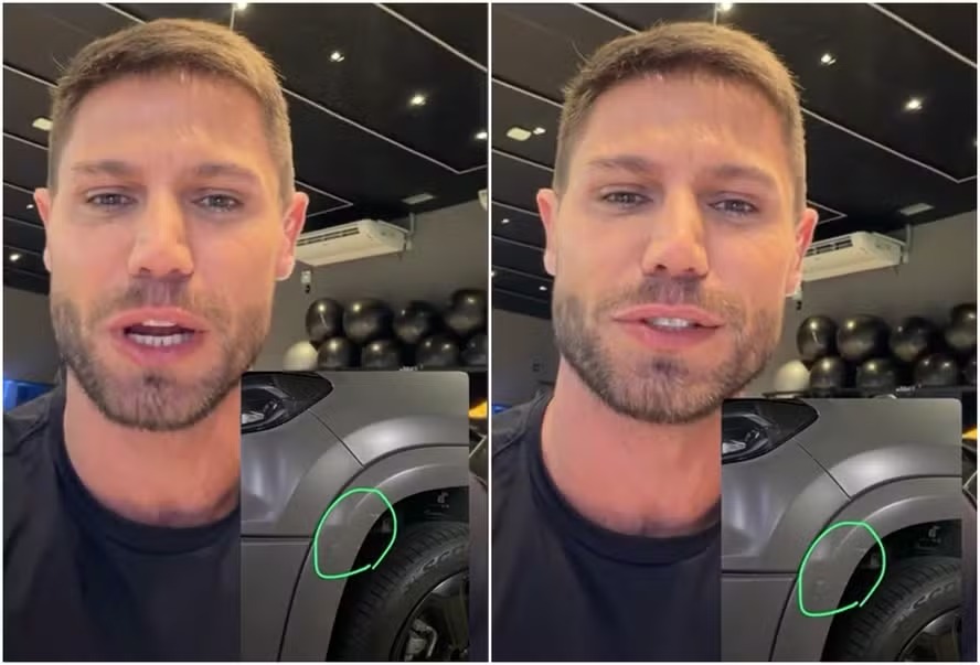 Ex-BBB Jonas Sulzbach tranquiliza fãs após acidente: ‘Dei uma raspadinha’