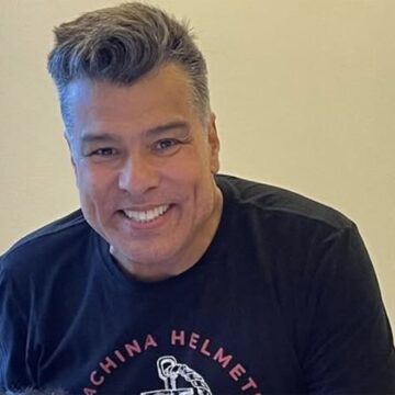 Maurício Mattar supera receio, faz harmonização facial e surpreende web com resultado; veja antes e depois