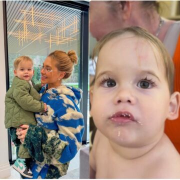 Virginia mostra machucado na testa de José Leonardo: ‘Levou uma mordida’