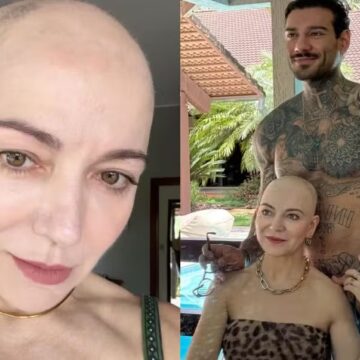 Mãe de Lucas Lucco relembra descoberta da alopecia: ‘Fazia barulho quando o cabelo caía no chão’